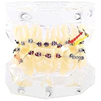 Akozon 1pcs Modelo de Dientes para Enseñanza Dentadura de Ortodoncia Modelo Dental para Tratamiento Modelo de Dientes…